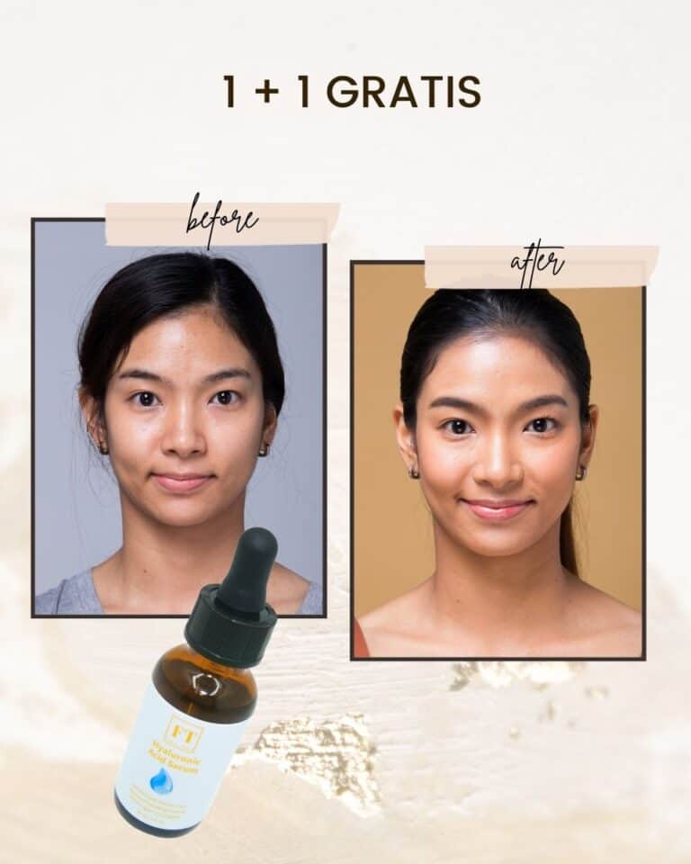 hyaluronzuur serum op model, hyaluronzuur serum met vitamine c en vitamine e serum, hydrateert de huid hyaluron