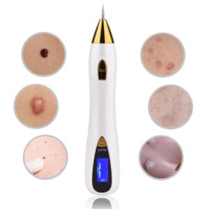 laser plasma pen - mole freckle pen
