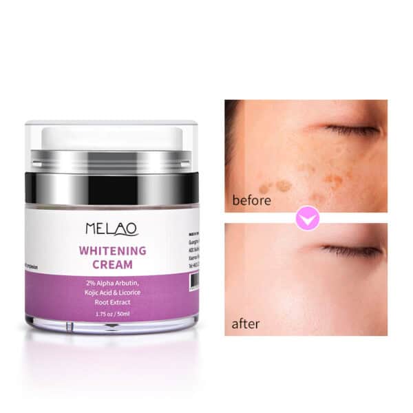 whitening cream 50 ml - pigmentvlekken crème 50 ml - voor en na gebruik