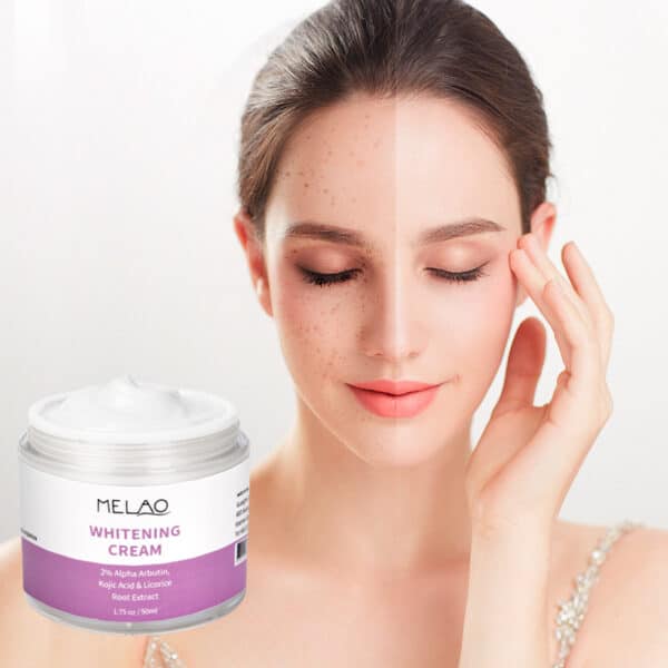 whitening cream 50 ml - pigmentvlekken crème 50 ml - op een vrouwelijk model