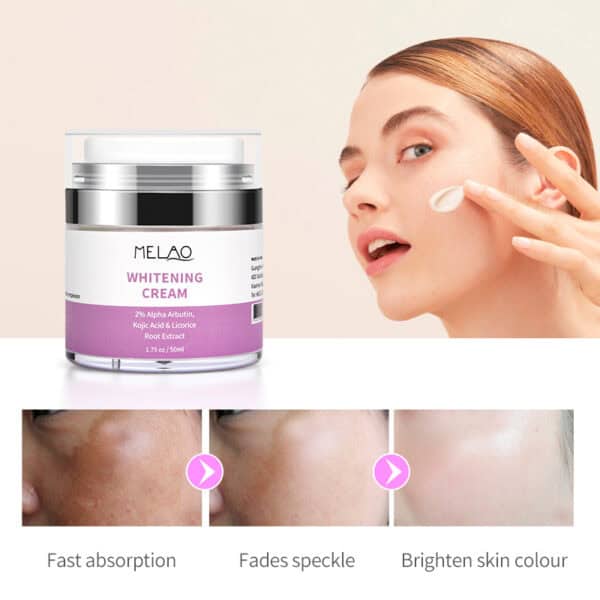 whitening cream 50 ml - pigmentvlekken crème 50 ml , op een vrouwelijk model