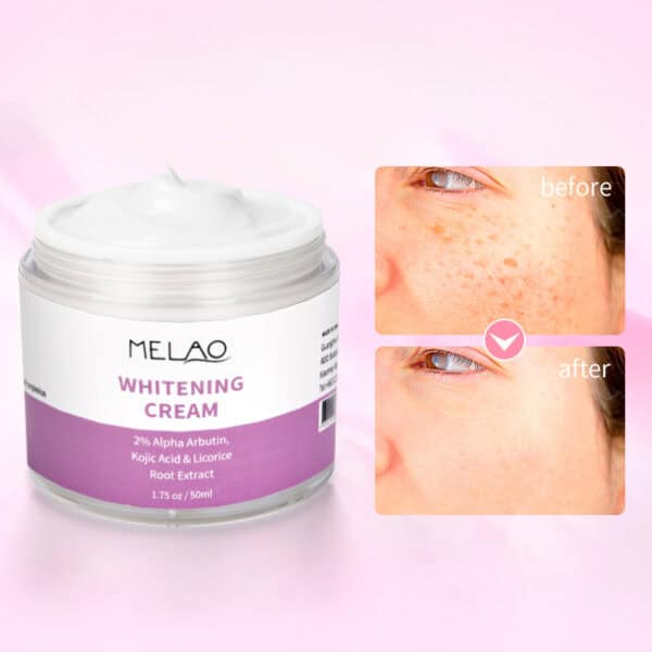 whitening cream 50 ml - pigmentvlekken crème 50 ml, voor en na gebruik